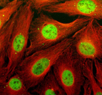 Immunofluorescent staining of TCF20 using anti-TCF20 antibody (green) and anti-Beta Tubulin antibody (red). TCF20 was detected in an immunocytochemical section of U2OS cells. Enzyme antigen retrieval was performed using IHC enzyme antigen retrieval reagent for 15 mins. The cells were blocked with 10% goat serum. And then incubated with 5 ug/ml rabbit anti-TCF20 antibody and mouse anti-Beta Tubulin antibody overnight at 4oC. DyLight 488 Conjugated Goat Anti-Rabbit IgG and Cy3 Conjugated Goat Anti-Mouse IgG were used as secondary antibody at 1:500 dilution and incubated for 30 minutes at 37oC. Visualize using a fluorescence microscope and filter sets appropriate for the label used.