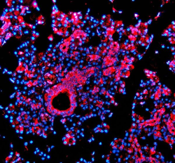 IF analysis of TMED10 using anti-TMED10 antibody (red). TMED10 was detected in a paraffin-embedded section of human parotid gland tissue. Heat mediated antigen retrieval was performed in EDTA buffer (pH 8.0, epitope retrieval solution). The tissue section was blocked with 10% goat serum. The tissue section was then incubated with 5 ug/ml rabbit anti-TMED10 antibody overnight at 4oC. Cy3 Conjugated Goat Anti-Rabbit IgG was used as secondary antibody at 1:500 dilution and incubated for 30 minutes at 37oC. The section was counterstained with DAPI (blue). Visualize using a fluorescence microscope and filter sets appropriate for the label used.