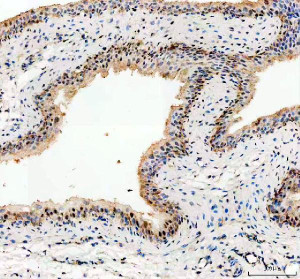 NEK7 Antibody Rat Bladder IHC. Immunohistochemistry staining of FFPE rat bladder tissue with NEK7 Antibody at 2 ug/ml. HIER was performed using pH 8 EDTA buffer, followed by blocking with 10% goat serum. The tissue section was incubated with rabbit anti-NEK7 antibody overnight at 4Â°C, followed by HRP-conjugated goat anti-rabbit IgG secondary antibody and DAB chromogen detection. NEK7 Antibody / Inflammasome Activation Protein Antibody demonstrates staining consistent with NIMA Related Kinase 7 expression and supports studies of NLRP3 inflammasome activation, innate immune signaling and inflammatory pathway regulation.