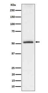 Western blot analysis of Phospho-Tau (pS198) expression in mouse hippocampus cell lysate. The expected molecular weight of phosphorylated Tau (pSer198) is approximately 45-70 kDa, corresponding to the major Tau isoforms, and lower molecular weight bands around ~35 kDa may represent truncated Tau fragments commonly observed in brain tissue.