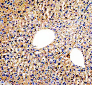 IHC analysis of SLC46A3 using anti-SLC46A3 antibody. SLC46A3 was detected in a paraffin-embedded section of mouse liver tissue. Heat mediated antigen retrieval was performed in EDTA buffer (pH 8.0, epitope retrieval solution). The tissue section was blocked with 10% goat serum. The tissue section was then incubated with 2 ug/ml rabbit anti-SLC46A3 antibody overnight at 4oC. Peroxidase Conjugated Goat Anti-rabbit IgG was used as secondary antibody and incubated for 30 minutes at 37oC. The tissue section was developed using an HRP secondary and DAB substrate.