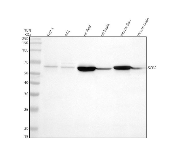 Western blot analysis of SCP2 using anti-SCP2 antibody. Electrophoresis was performed on a 10% SDS-PAGE gel at 80V (Stacking gel) / 120V (Resolving gel) for 2 hours. Lane 1: human THP-1 whole cell lysates, Lane 2: human RT4 whole cell lysates, Lane 3: rat liver tissue lysates, Lane 4: rat brain tissue lysates, Lane 5: mouse liver tissue lysates, Lane 6: mouse brain tissue lysates. After electrophoresis, proteins were transferred to a nitrocellulose membrane at 150 mA for 50-90 minutes. Blocked the membrane with 5% non-fat milk/TBS for 1.5 hour at RT. The membrane was incubated with rabbit anti-SCP2 antibody at 0.5 ug/ml overnight at 4oC, then washed with TBS-0.1%Tween 3 times with 5 minutes each and probed with a goat anti-rabbit IgG-HRP secondary antibody at a dilution of 1:5000 for 1.5 hour at RT. The signal was developed using an ECL Plus Western Blotting Substrate. A specific band was detected for SCP2 at approximately 59 kDa. The expected band size for SCP2 is at 59 kDa.