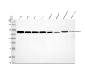 Western blot analysis of SGMS1 using anti-SGMS1 antibody. Electrophoresis was performed on a 12% SDS-PAGE gel at 80V (Stacking gel) / 120V (Resolving gel) for 2 hours. Lane 1: human K562 whole cell lysates, Lane 2: human HEL whole cell lysates, Lane 3: human RT4 whole cell lysates, Lane 4: human PC-3 whole cell lysates, Lane 5: rat testis tissue lysates, Lane 6: rat heart tissue lysates, Lane 7: mouse testis tissue lysates, Lane 8: mouse heart tissue lysates. After electrophoresis, proteins were transferred to a nitrocellulose membrane at 150 mA for 50-90 minutes. Blocked the membrane with 5% non-fat milk/TBS for 1.5 hour at RT. The membrane was incubated with rabbit anti-SGMS1 antibody at 1:1000 overnight at 4oC, then washed with TBS-0.1%Tween 3 times with 5 minutes each and probed with a goat anti-rabbit IgG-HRP secondary antibody at a dilution of 1:5000 for 1.5 hour at RT. The signal was developed using an ECL Plus Western Blotting Substrate. The expected band size for SGMS1 is at ~49 kDa.