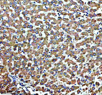IHC analysis of SUCO using anti-SUCO antibody. SUCO was detected in a paraffin-embedded section of human liver tissue. Heat mediated antigen retrieval was performed in EDTA buffer (pH 8.0, epitope retrieval solution). The tissue section was blocked with 10% goat serum. The tissue section was then incubated with 2 ug/ml rabbit anti-SUCO antibody overnight at 4oC. Peroxidase Conjugated Goat Anti-rabbit IgG was used as secondary antibody and incubated for 30 minutes at 37oC. The tissue section was developed using an HRP secondary and DAB substrate.