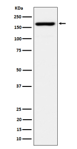 Western blot analysis of eIF3A expression in Jurkat cell lysate using EIF3A antibody.