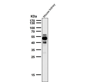 All lanes use the Phospho-Tau (pSer404) antibody at 1:2K dilution for 1 hour at room temperature. The expected molecular weight of phosphorylated Tau (Ser198) is approximately 45-70 kDa, corresponding to the major Tau isoforms, and lower molecular weight bands around ~35 kDa may represent truncated Tau fragments commonly observed in brain tissue.