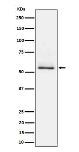 Western blot analysis of Phospho-Tau (S404) expression in mouse brain cell lysate using Phospho-Tau (pSer404) antibody. The expected molecular weight of phosphorylated Tau (Ser198) is approximately 45-70 kDa, corresponding to the major Tau isoforms, and lower molecular weight bands around ~35 kDa may represent truncated Tau fragments commonly observed in brain tissue.