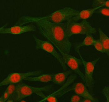 IF analysis of RBBP8 using anti-RBBP8 antibody (red) and anti-Beta Tubulin antibody (green). RBBP8 was detected in immunocytochemical section of HELA cell. Enzyme antigen retrieval was performed using IHC enzyme antigen retrieval reagent for 15 mins. The cells were blocked with 10% goat serum. And then incubated with 5 ug/ml rabbit anti-RBBP8 antibody and mouse anti-Beta Tubulin antibody overnight at 4oC. Cy3 Conjugated Goat Anti-Rabbit IgG and FITC Conjugated Goat Anti-Mouse IgG were used as secondary antibody at 1:500 dilution and incubated for 30 minutes at 37oC. Visualize using a fluorescence microscope and filter sets appropriate for the label used.