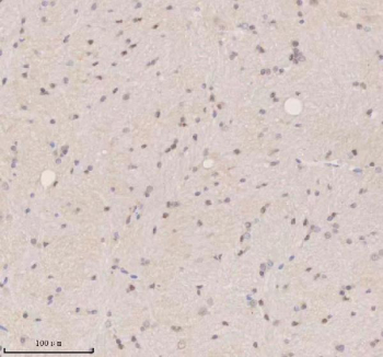IHC analysis of SSX2IP using anti-SSX2IP antibody. SSX2IP was detected in a paraffin-embedded section of rat brain tissue. Heat mediated antigen retrieval was performed in EDTA buffer (pH 8.0, epitope retrieval solution). The tissue section was blocked with 10% goat serum. The tissue section was then incubated with 2 ug/ml rabbit anti-SSX2IP antibody overnight at 4oC. Peroxidase Conjugated Goat Anti-rabbit IgG was used as secondary antibody and incubated for 30 minutes at 37oC. The tissue section was developed using an HRP secondary and DAB substrate.