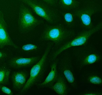 IF analysis of PHGDH using anti-PHGDH antibody (green). PHGDH was detected in an immunocytochemical section of U2OS cells. Enzyme antigen retrieval was performed using IHC enzyme antigen retrieval reagent for 15 mins. The cells were blocked with 10% goat serum. And then incubated with 5 ug/ml rabbit anti-PHGDH antibody overnight at 4oC. DyLight 488 Conjugated Goat Anti-Rabbit IgG was used as secondary antibody at 1:500 dilution and incubated for 30 minutes at 37oC. The section was counterstained with DAPI (blue). Visualize using a fluorescence microscope and filter sets appropriate for the label used.