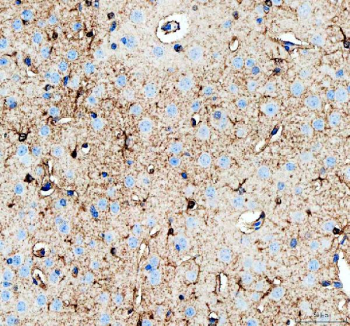 IHC analysis of PHGDH using anti-PHGDH antibody. PHGDH was detected in a paraffin-embedded section of mouse brain tissue. Heat mediated antigen retrieval was performed in EDTA buffer (pH 8.0, epitope retrieval solution). The tissue section was blocked with 10% goat serum. The tissue section was then incubated with 2 ug/ml rabbit anti-PHGDH antibody overnight at 4oC. Peroxidase Conjugated Goat Anti-rabbit IgG was used as secondary antibody and incubated for 30 minutes at 37oC. The tissue section was developed using an HRP secondary and DAB substrate.