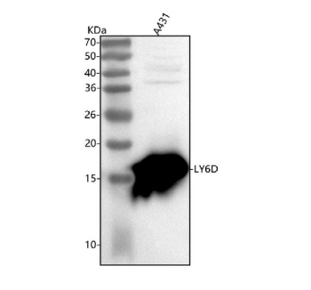 Western blot analysis of LY6D using anti-LY6D antibody. Lane 1: human whole cell lysates. After electrophoresis, proteins were transferred to a nitrocellulose membrane at 150 mA for 50-90 minutes. Blocked the membrane with 5% non-fat milk/TBS for 1.5 hour at RT. The membrane was incubated with rabbit anti-LY6D antibody at 0.25 ug/ml overnight at 4oC, then washed with TBS-0.1%Tween 3 times with 5 minutes each and probed with a goat anti-rabbit IgG-HRP secondary antibody at a dilution of 1:5000 for 1.5 hour at RT. The signal was developed using enhanced chemiluminescent. The expected band size for LY6D is at 13 kDa but can be observed at 15-17 kDa due to glycosylation.