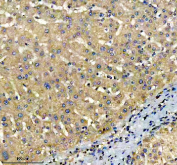 IHC analysis of TOP1MT using anti-TOP1MT antibody. TOP1MT was detected in a paraffin-embedded section of human liver tissue. Heat mediated antigen retrieval was performed in EDTA buffer (pH 8.0, epitope retrieval solution). The tissue section was blocked with 10% goat serum. The tissue section was then incubated with 2 ug/ml rabbit anti-TOP1MT antibody overnight at 4oC. Peroxidase Conjugated Goat Anti-rabbit IgG was used as secondary antibody and incubated for 30 minutes at 37oC. The tissue section was developed using an HRP secondary and DAB substrate.