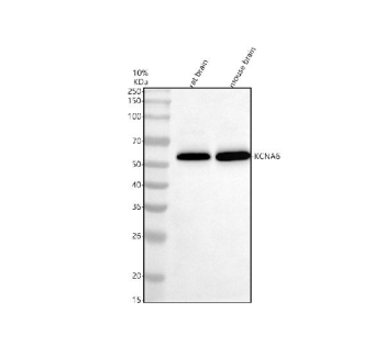 Western blot analysis of KCNA6 using anti-KCNA6 antibody. Electrophoresis was performed on a 10% SDS-PAGE gel at 80V (Stacking gel) / 120V (Resolving gel) for 2 hours. Lane 1: rat brain tissue lysates, Lane 2: mouse brain tissue lysates. After electrophoresis, proteins were transferred to a nitrocellulose membrane at 150 mA for 50-90 minutes. Blocked the membrane with 5% non-fat milk/TBS for 1.5 hour at RT. The membrane was incubated with rabbit anti-KCNA6 antibody at 0.5 ug/ml overnight at 4oC, then washed with TBS-0.1%Tween 3 times with 5 minutes each and probed with a goat anti-rabbit IgG-HRP secondary antibody at a dilution of 1:5000 for 1.5 hour at RT. The signal was developed using an ECL Plus Western Blotting Substrate. A specific band was detected for KCNA6 at approximately 59 kDa. The expected band size for KCNA6 is at 59 kDa.