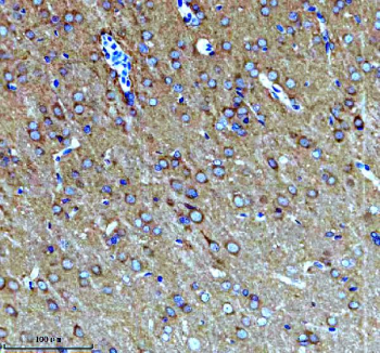 IHC analysis of KCNA6 using anti-KCNA6 antibody. KCNA6 was detected in a paraffin-embedded section of rat brain tissue. Heat mediated antigen retrieval was performed in EDTA buffer (pH 8.0, epitope retrieval solution). The tissue section was blocked with 10% goat serum. The tissue section was then incubated with 2 ug/ml rabbit anti-KCNA6 antibody overnight at 4oC. Peroxidase Conjugated Goat Anti-rabbit IgG was used as secondary antibody and incubated for 30 minutes at 37oC. The tissue section was developed using an HRP secondary and DAB substrate.