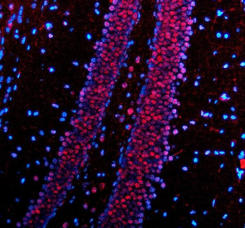 Immunofluorescent staining of PABPN1 using anti-PABPN1 antibody (red). PABPN1 was detected in a paraffin-embedded section of mouse brain tissue. Heat mediated antigen retrieval was performed in EDTA buffer (pH 8.0, epitope retrieval solution). The tissue section was blocked with 10% goat serum. The tissue section was then incubated with 5 ug/ml rabbit anti-PABPN1 antibody overnight at 4oC. Cy3 Conjugated Goat Anti-Rabbit IgG was used as secondary antibody at 1:500 dilution and incubated for 30 minutes at 37oC. The section was counterstained with DAPI (blue). Visualize using a fluorescence microscope and filter sets appropriate for the label used.