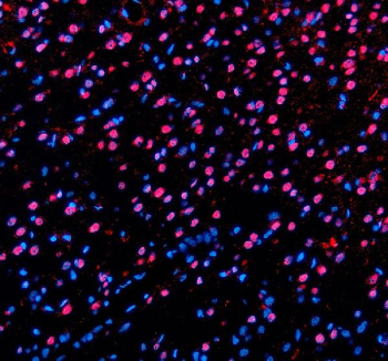 Immunofluorescent staining of PABPN1 using anti-PABPN1 antibody (red). PABPN1 was detected in a paraffin-embedded section of rat brain tissue. Heat mediated antigen retrieval was performed in EDTA buffer (pH 8.0, epitope retrieval solution). The tissue section was blocked with 10% goat serum. The tissue section was then incubated with 5 ug/ml rabbit anti-PABPN1 antibody overnight at 4oC. Cy3 Conjugated Goat Anti-Rabbit IgG was used as secondary antibody at 1:500 dilution and incubated for 30 minutes at 37oC. The section was counterstained with DAPI. Visualize using a fluorescence microscope and filter sets appropriate for the label used.