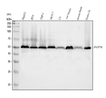 Western blot analysis of PABPN1 using anti-PABPN1 antibody. Electrophoresis was performed on a 10% SDS-PAGE gel at 80V (Stacking gel) / 120V (Resolving gel) for 2 hours. Lane 1: human HepG2 whole cell lysates, Lane 2: human RT4 whole cell lysates, Lane 3: human THP-1 whole cell lysates, Lane 4: human MCF-7 whole cell lysates, Lane 5: rat C6 whole cell lysates, Lane 6: rat brain tissue lysates, Lane 7: mouse brain tissue lysates, Lane 8: mouse Neuro-2a whole cell lysates. After electrophoresis, proteins were transferred to a nitrocellulose membrane at 150 mA for 50-90 minutes. Blocked the membrane with 5% non-fat milk/TBS for 1.5 hour at RT. The membrane was incubated with rabbit anti-PABPN1 antibody at 0.5 ug/ml overnight at 4oC, then washed with TBS-0.1%Tween 3 times with 5 minutes each and probed with a goat anti-rabbit IgG-HRP secondary antibody at a dilution of 1:5000 for 1.5 hour at RT. The signal was developed using an ECL Plus Western Blotting Substrate. The expected band size for PABPN1 is at 33 kDa but the protein is commonly observed at ~50 kDa due to its acidic, low-SDS-binding N-terminus and arginine-rich C-terminus.