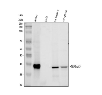 Western blot analysis of GIMAP5 using anti-GIMAP5 antibody. Electrophoresis was performed on a 10% SDS-PAGE gel at 80V (Stacking gel) / 120V (Resolving gel) for 2 hours. Lane 1: human Jurkat whole cell lysates, Lane 2: human HeLa whole cell lysates, Lane 3: rat thymus whole cell lysates and Lane 4: rat spleen whole cell lysates. After electrophoresis, proteins were transferred to a nitrocellulose membrane at 150 mA for 50-90 minutes. Blocked the membrane with 5% non-fat milk/TBS for 1.5 hour at RT. The membrane was incubated with rabbit anti-GIMAP5 antibody at 0.5 ug/ml overnight at 4oC, then washed with TBS-0.1%Tween 3 times with 5 minutes each and probed with a goat anti-rabbit IgG-HRP secondary antibody at a dilution of 1:5000 for 1.5 hour at RT. The signal was developed using an ECL Plus Western Blotting Substrate. The expected band size for GIMAP5 is at 35 kDa. With a lymphocyte-specific expression pattern, GIMAP5 should not be observed in HeLa cells (epithelial).