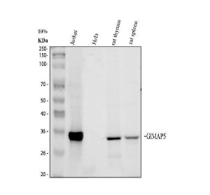 GIMAP5 Antibody Human Immune Tissue WB. Western blot analysis using GIMAP5 Antibody. Lane 1: human Jurkat cells; Lane 2: human HeLa cells; Lane 3: rat thymus tissue; Lane 4: rat spleen tissue. A specific band is detected at approximately 35 kDa in Jurkat cells and rat lymphoid tissues, consistent with the expected molecular weight of GIMAP5, while little to no signal is observed in HeLa cells. This expression pattern is consistent with the preferential expression of GIMAP5 in lymphoid cells and tissues. These results support the use of GIMAP5 Antibody / GTPase IMAP Family Member 5 for studying lymphocyte biology, immune homeostasis and GTPase-mediated signaling.