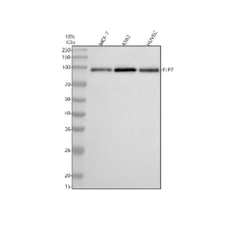 Western blot analysis of ELP2 using anti-ELP2 antibody. Electrophoresis was performed on a 10% SDS-PAGE gel at 80V (Stacking gel) / 120V (Resolving gel) for 2 hours. Lane 1: human MCF-7 whole cell lysates, Lane 2: human K562 whole cell lysates, Lane 3: human HUVEC whole cell lysates. After electrophoresis, proteins were transferred to a nitrocellulose membrane at 150 mA for 50-90 minutes. Blocked the membrane with 5% non-fat milk/TBS for 1.5 hour at RT. The membrane was incubated with rabbit anti-ELP2 antibody at 0.5 ug/ml overnight at 4oC, then washed with TBS-0.1%Tween 3 times with 5 minutes each and probed with a goat anti-rabbit IgG-HRP secondary antibody at a dilution of 1:5000 for 1.5 hour at RT. The signal was developed using an ECL Plus Western Blotting Substrate. A specific band was detected for ELP2 at approximately 93 kDa. The expected band size for ELP2 is at 93 kDa.
