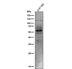 All lanes use the Phospho-Tau (pSer214) antibody at 1:1k dilution for 1 hour at room temperature. The expected molecular weight of phosphorylated Tau (Ser198) is approximately 45-70 kDa, corresponding to the major Tau isoforms, and lower molecular weight bands around ~35 kDa may represent truncated Tau fragments commonly observed in brain tissue.
