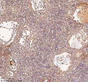 IHC staining of FFPE human spleen tissue with SAMD9L antibody, HRP-secondary and DAB substrate. HIER: boil tissue sections in pH8 EDTA for 20 min and allow to cool before testing.