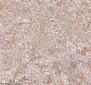 IHC staining of FFPE human testicular seminoma tissue with SAMD9L antibody, HRP-secondary and DAB substrate. HIER: boil tissue sections in pH8 EDTA for 20 min and allow to cool before testing.