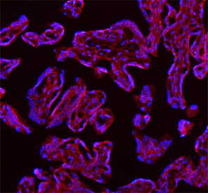 Immunofluorescent staining of FFPE human placental tissue with SAMD9L antibody (red) and DAPI nuclear stain (blue). HIER: steam section in pH8 EDTA buffer for 20 min.