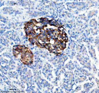 IHC analysis of TRIM58 using anti-TRIM58 antibody. TRIM58 was detected in a paraffin-embedded section of human pancreas tissue. Heat mediated antigen retrieval was performed in EDTA buffer (pH 8.0, epitope retrieval solution). The tissue section was blocked with 10% goat serum. The tissue section was then incubated with 2 ug/ml rabbit anti-TRIM58 antibody overnight at 4oC. Peroxidase Conjugated Goat Anti-rabbit IgG was used as secondary antibody and incubated for 30 minutes at 37oC. The tissue section was developed using an HRP secondary and DAB substrate.