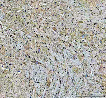 IHC analysis of PLD5 using anti-PLD5 antibody. PLD5 was detected in a paraffin-embedded section of rat cerebellum tissue. Heat mediated antigen retrieval was performed in EDTA buffer (pH 8.0, epitope retrieval solution). The tissue section was blocked with 10% goat serum. The tissue section was then incubated with 2 ug/ml rabbit anti-PLD5 antibody overnight at 4oC. Peroxidase Conjugated Goat Anti-rabbit IgG was used as secondary antibody and incubated for 30 minutes at 37oC. The tissue section was developed using an HRP secondary and DAB substrate.