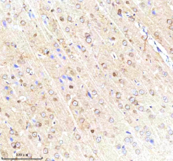 IHC analysis of SCNM1 using anti-SCNM1 antibody. SCNM1 was detected in a paraffin-embedded section of rat brain tissue. Heat mediated antigen retrieval was performed in EDTA buffer (pH 8.0, epitope retrieval solution). The tissue section was blocked with 10% goat serum. The tissue section was then incubated with 2 ug/ml rabbit anti-SCNM1 antibody overnight at 4oC. Peroxidase Conjugated Goat Anti-rabbit IgG was used as secondary antibody and incubated for 30 minutes at 37oC. The tissue section was developed using an HRP secondary and DAB substrate.