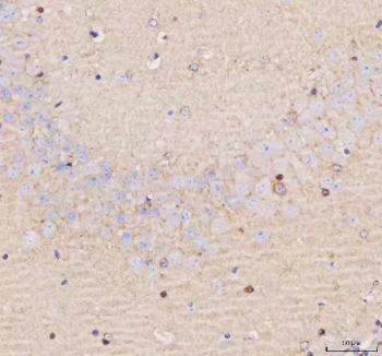 IHC analysis of SCNM1 using anti-SCNM1 antibody. SCNM1 was detected in a paraffin-embedded section of mouse brain tissue. Heat mediated antigen retrieval was performed in EDTA buffer (pH 8.0, epitope retrieval solution). The tissue section was blocked with 10% goat serum. The tissue section was then incubated with 2 ug/ml rabbit anti-SCNM1 antibody overnight at 4oC. Peroxidase Conjugated Goat Anti-rabbit IgG was used as secondary antibody and incubated for 30 minutes at 37oC. The tissue section was developed using an HRP secondary and DAB substrate.