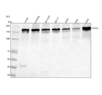 Western blot analysis of CLCN3 using anti-CLCN3 antibody. Lane 1: human Jurkat whole cell lysates, Lane 2: human U-87MG whole cell lysates, Lane 3: human SH-SY6Y whole cell lysates, Lane 4: human MCF-7 whole cell lysates, Lane 5: human whole cell lysates, Lane 6: human Hela whole cell lysates, Lane 7: human K562 whole cell lysates. After electrophoresis, proteins were transferred to a nitrocellulose membrane at 150 mA for 50-90 minutes. Blocked the membrane with 5% non-fat milk/TBS for 1.5 hour at RT. The membrane was incubated with rabbit anti-CLCN3 antibody at 0.5 ug/ml overnight at 4oC, then washed with TBS-0.1%Tween 3 times with 5 minutes each and probed with a goat anti-rabbit IgG-HRP secondary antibody at a dilution of 1:5000 for 1.5 hour at RT. The signal was developed using enhanced chemiluminescent. The expected band size for CLCN3 is at 91 kDa but the protein is N-glycosylated and forms homodimers of ~170 kDa.
