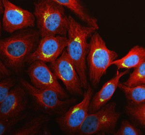 GALNT7 Antibody HeLa Cell IF. Immunofluorescence analysis of HeLa cells using GALNT7 Antibody (green) and alpha tubulin antibody (red). Cells were treated with enzyme antigen retrieval reagent for 15 minutes prior to blocking with goat serum and overnight incubation with GALNT7 Antibody (5 ug/mL) and alpha tubulin antibody at 4Â°C. Fluoro488- and Cy3-conjugated secondary antibodies were used for detection, and DAPI (blue) was used as a nuclear counterstain. GALNT7 displays a concentrated perinuclear staining pattern consistent with Golgi localization, while alpha tubulin highlights the cytoskeletal network. These results support the use of GALNT7 Antibody / O-Glycosylation Enzyme Antibody for studying GALNT7 expression, Golgi organization and protein O-glycosylation.