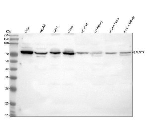 Western blot analysis of GALNT7 using anti-GALNT7 antibody. Lane 1: human Hela whole cell lysates, Lane 2: human HepG2 whole cell lysates, Lane 3: human whole cell lysates, Lane 4: human Hacat whole cell lysates, Lane 5: rat brain tissue lysates, Lane 6: rat kidney tissue lysates, Lane 7: mouse brain tissue lysates, Lane 8: mouse kidney tissue lysates. After electrophoresis, proteins were transferred to a nitrocellulose membrane at 150 mA for 50-90 minutes. Blocked the membrane with 5% non-fat milk/TBS for 1.5 hour at RT. The membrane was incubated with rabbit anti-GALNT7 antibody at 0.5 ug/ml overnight at 4oC, then washed with TBS-0.1%Tween 3 times with 5 minutes each and probed with a goat anti-rabbit IgG-HRP secondary antibody at a dilution of 1:5000 for 1.5 hour at RT. The signal was developed using enhanced chemiluminescent. A specific band was detected for GALNT7 at approximately 75 kDa. The expected band size for GALNT7 is at 75 kDa.