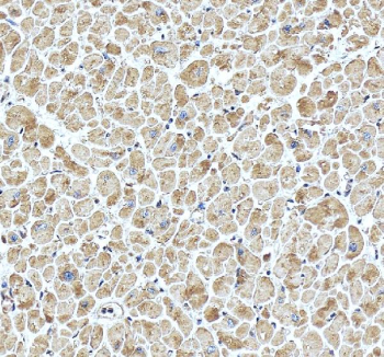 IHC analysis of PAM using anti-PAM antibody. PAM was detected in a paraffin-embedded section of human heart tissue. Heat mediated antigen retrieval was performed in EDTA buffer (pH 8.0, epitope retrieval solution). The tissue section was blocked with 10% goat serum. The tissue section was then incubated with 2 ug/ml rabbit anti-PAM antibody overnight at 4oC. Peroxidase Conjugated Goat Anti-rabbit IgG was used as secondary antibody and incubated for 30 minutes at 37oC. The tissue section was developed using an HRP secondary and DAB substrate.