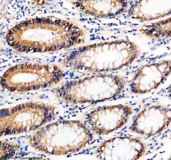 IHC analysis of UBE2A/UBE2B using anti-UBE2A/UBE2B antibody. UBE2A/UBE2B was detected in a paraffin-embedded section of human colon tissue. Heat mediated antigen retrieval was performed in EDTA buffer (pH 8.0, epitope retrieval solution). The tissue section was blocked with 10% goat serum. The tissue section was then incubated with 2 ug/ml rabbit anti-UBE2A/UBE2B antibody overnight at 4oC. Peroxidase Conjugated Goat Anti-rabbit IgG was used as secondary antibody and incubated for 30 minutes at 37oC. The tissue section was developed using an HRP secondary and DAB substrate.