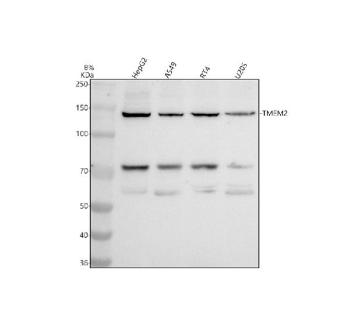 Western blot analysis of CEMIP2 using anti-CEMIP2 antibody. Electrophoresis was performed on a 8% SDS-PAGE gel at 80V (Stacking gel) / 120V (Resolving gel) for 2 hours. Lane 1: human HepG2 whole cell lysates, Lane 2: human whole cell lysates, Lane 3: human RT4 whole cell lysates, Lane 4: human U2OS whole cell lysates. After electrophoresis, proteins were transferred to a nitrocellulose membrane at 150 mA for 50-90 minutes. Blocked the membrane with 5% non-fat milk/TBS for 1.5 hour at RT. The membrane was incubated with rabbit anti-CEMIP2 antibody at 0.5 ug/ml overnight at 4oC, then washed with TBS-0.1%Tween 3 times with 5 minutes each and probed with a goat anti-rabbit IgG-HRP secondary antibody at a dilution of 1:5000 for 1.5 hour at RT. The signal was developed using an ECL Plus Western Blotting Substrate. The expected band size for CEMIP2 is at 147 kDa along with smaller ~70 and ~55 kDa products, likely derived from N-terminal proteolytic cleavage.