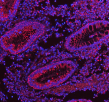 Immunofluorescent staining of FFPE human appendix tissue with HERPUD1 antibody (red) and DAPI nuclear stain (blue). HIER: steam section in pH8 EDTA buffer for 20 min.