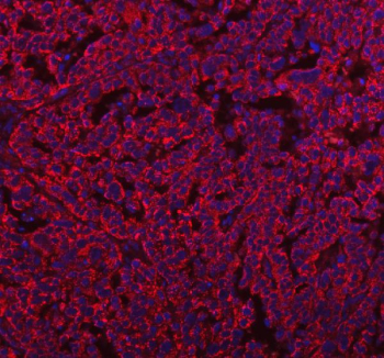 Immunofluorescent staining of FFPE human ovarian tissue with HERPUD1 antibody (red) and DAPI nuclear stain (blue). HIER: steam section in pH8 EDTA buffer for 20 min.