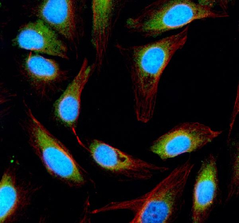 Immunofluorescent staining of ESD using anti-ESD antibody (green) and anti-Beta Tubulin antibody (red). ESD was detected in an immunocytochemical section of U2OS cells. Enzyme antigen retrieval was performed using IHC enzyme antigen retrieval reagent for 15 mins. The cells were blocked with 10% goat serum. And then incubated with 5 ug/ml rabbit anti-ESD antibody and mouse anti-Beta Tubulin antibody overnight at 4oC. DyLight 488 Conjugated Goat Anti-Rabbit IgG and Cy3 Conjugated Goat Anti-Mouse IgG were used as secondary antibody at 1:500 dilution and incubated for 30 minutes at 37oC. The section was counterstained with DAPI nuclear stain (blue). Visualize using a fluorescence microscope and filter sets appropriate for the label used.