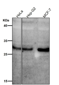 All lanes use the Phospho-MST1/MST2 (pThr183/pThr180) antibody at 1:1000 dilution for 1 hour at room temperature.