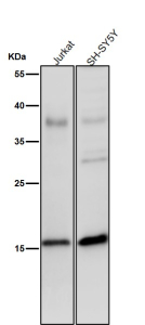 Phospho-Histone H3 (pSer28) Antibody / HIST1H3A Chromosome Condensation Marker Antibody for WB. Western blot analysis of HIST1H3A / Histone H3 Ser28 phosphorylation in human Jurkat and SH-SY5Y cell lysates using Phospho-Histone H3 (pSer28) Antibody / HIST1H3A Chromosome Condensation Marker Antibody. A band is detected at the predicted molecular weight of approximately 15 kDa corresponding to Histone H3, with signal reflecting Ser28 phosphorylation associated with Aurora B-driven chromosome condensation in mitotic cells. All lanes were incubated with the antibody at 1:2000 dilution for 1 hour at room temperature.