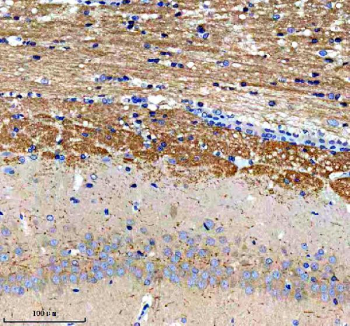 Immunohistochemical staining of PTCD3 using anti-PTCD3 antibody. PTCD3 was detected in a paraffin-embedded section of rat brain tissue. Heat mediated antigen retrieval was performed in EDTA buffer (pH 8.0, epitope retrieval solution). The tissue section was blocked with 10% goat serum. The tissue section was then incubated with 2 ug/ml rabbit anti-PTCD3 antibody overnight at 4oC. Peroxidase Conjugated Goat Anti-rabbit IgG was used as secondary antibody and incubated for 30 minutes at 37oC. The tissue section was developed using an HRP secondary and DAB substrate.