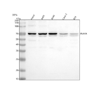 Western blot analysis of INAVA using anti-INAVA antibody. Lane 1: human Hacat whole cell lysates, Lane 2: human whole cell lysates, Lane 3: human whole cell lysates, Lane 4: human Caco-2 whole cell lysates, Lane 5: human RT4 whole cell lysates. After electrophoresis, proteins were transferred to a nitrocellulose membrane at 150 mA for 50-90 minutes. Blocked the membrane with 5% non-fat milk/TBS for 1.5 hour at RT. The membrane was incubated with rabbit anti-INAVA antibody at 0.5 ug/ml overnight at 4oC, then washed with TBS-0.1%Tween 3 times with 5 minutes each and probed with a goat anti-rabbit IgG-HRP secondary antibody at a dilution of 1:5000 for 1.5 hour at RT. The signal was developed using enhanced chemiluminescent. The expected band size for INAVA is at 73/64 kDa (two isoforms).