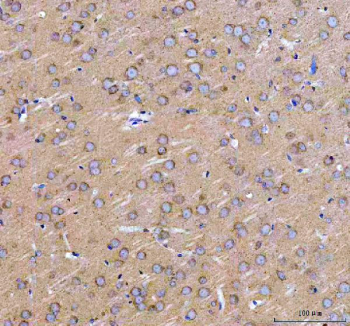 Immunohistochemical staining of ARHGEF12L using anti-ARHGEF12L antibody. ARHGEF12L was detected in a paraffin-embedded section of rat brain tissue. Heat mediated antigen retrieval was performed in EDTA buffer (pH 8.0, epitope retrieval solution). The tissue section was blocked with 10% goat serum. The tissue section was then incubated with 2 ug/ml rabbit anti-ARHGEF12L antibody overnight at 4oC. Peroxidase Conjugated Goat Anti-rabbit IgG was used as secondary antibody and incubated for 30 minutes at 37oC. The tissue section was developed using an HRP secondary and DAB substrate.