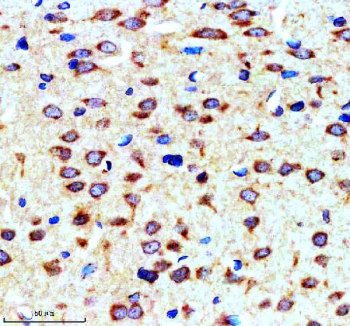 SORL1 Antibody Rat Brain IHC. Immunohistochemical staining of FFPE rat brain tissue with SORL1 antibody demonstrated moderate cytoplasmic and membranous staining in neuronal cells, consistent with the localization of SORL1 (Sortilin-Related Receptor 1), a VPS10-domain sorting receptor that regulates intracellular protein trafficking, endosomal sorting, and receptor recycling. SORL1 is a key regulator of amyloid precursor protein (APP) trafficking and neuronal protein homeostasis, making it an important marker in Alzheimer's disease and neurodegeneration research. Heat-mediated antigen retrieval was performed in pH 8.0 EDTA buffer, followed by overnight incubation with SORL1 antibody at 2 ug/ml. Detection was achieved using an HRP-conjugated secondary antibody and DAB substrate.