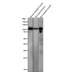 All lanes use the Phospho-AMPA Receptor 1 (pSer831) antibody at 1:1000 dilution for 1 hour at room temperature.