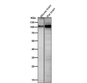 All lanes use the Phospho-AMPA Receptor 1 (pSer831) antibody at 1:1000 dilution for 1 hour at room temperature.
